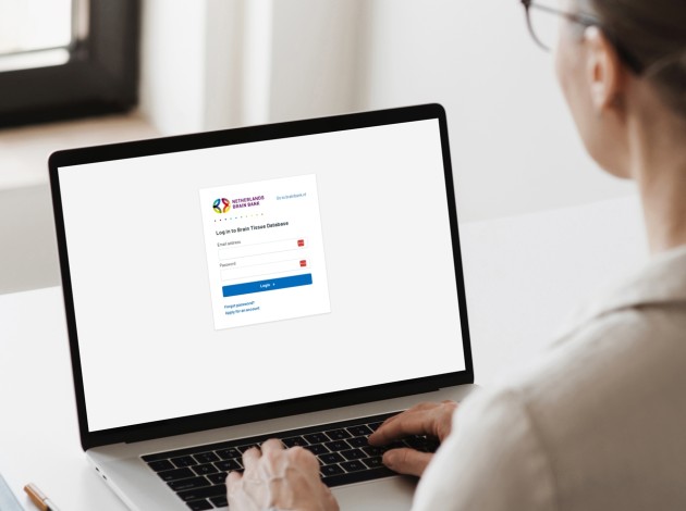Een laptop met daarop de webapplicatie voor de Nederlandse Hersenbank