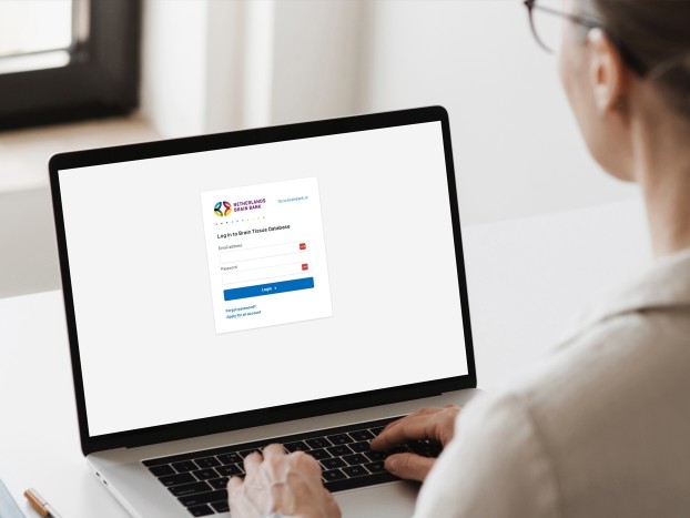 A laptop with the web application for the Nederlandse Hersenbank